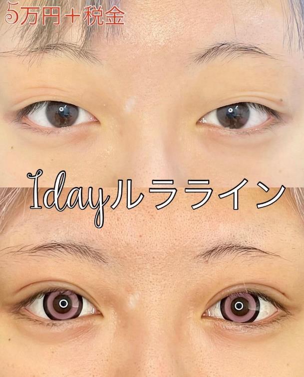 1dayルラライン