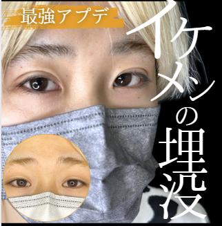 二重埋没