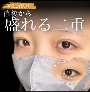 二重埋没