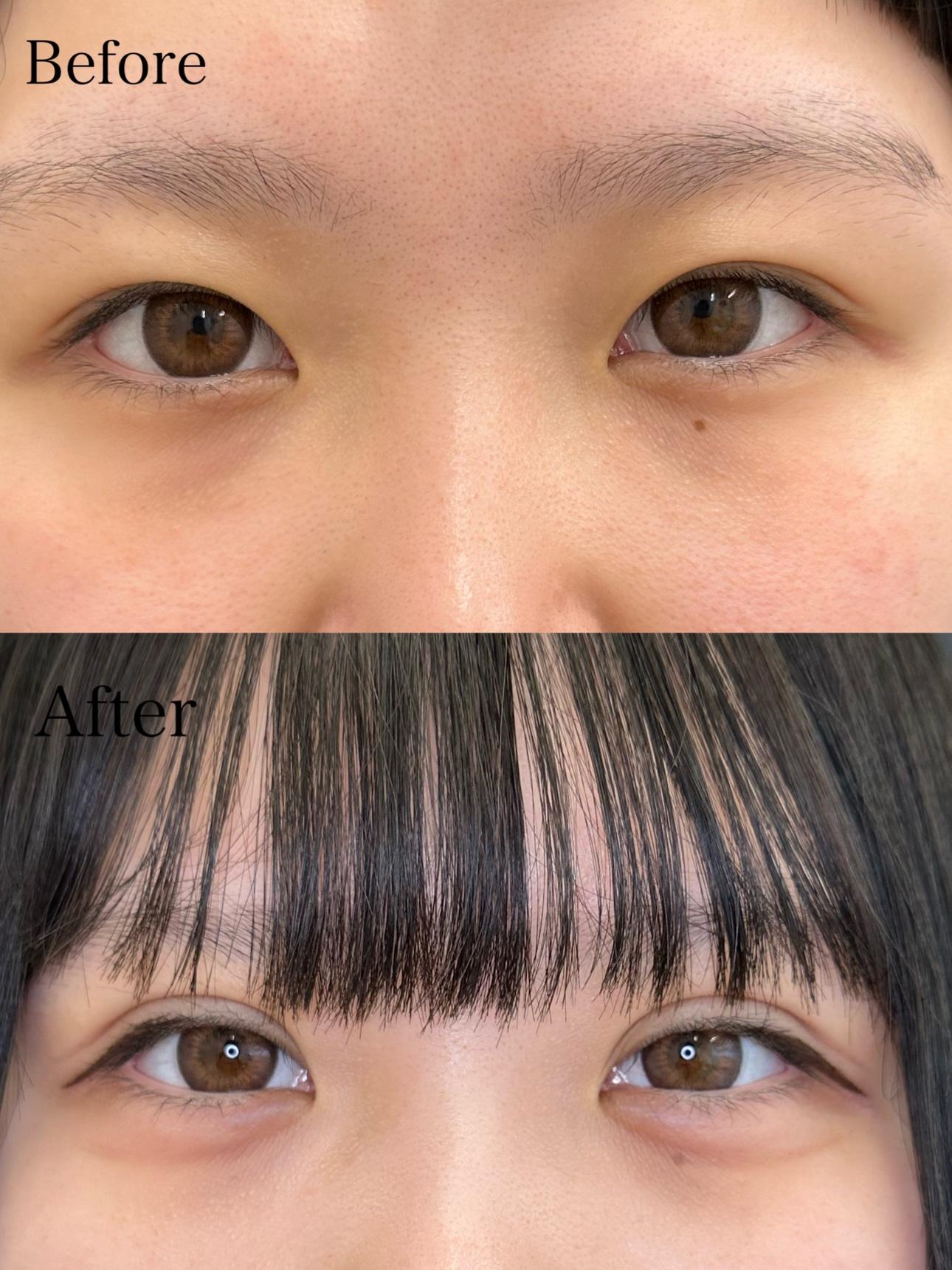 二重埋没