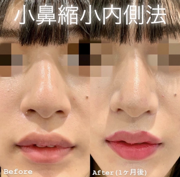 顔 コラム ルラ Lula 美容クリニック 顔 コラム ルラ Lula 美容クリニック