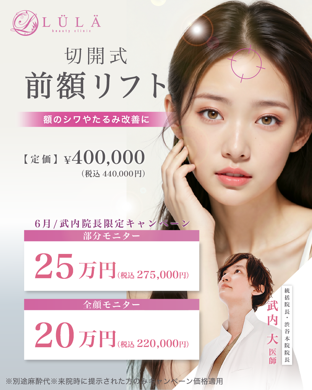 前額リフト手術とは?