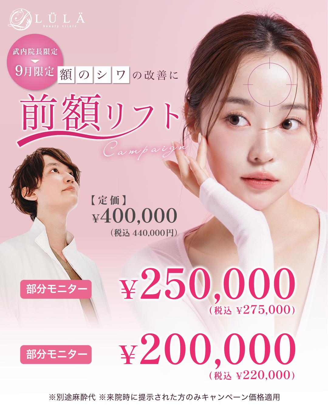 前額リフト手術とは？