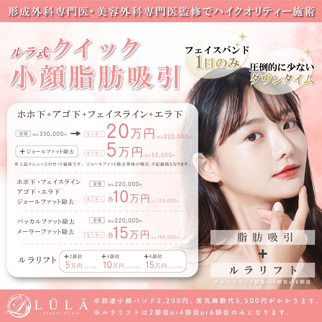 顔の脂肪吸引とは