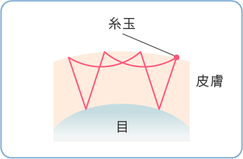 二重埋没法メニュー料金