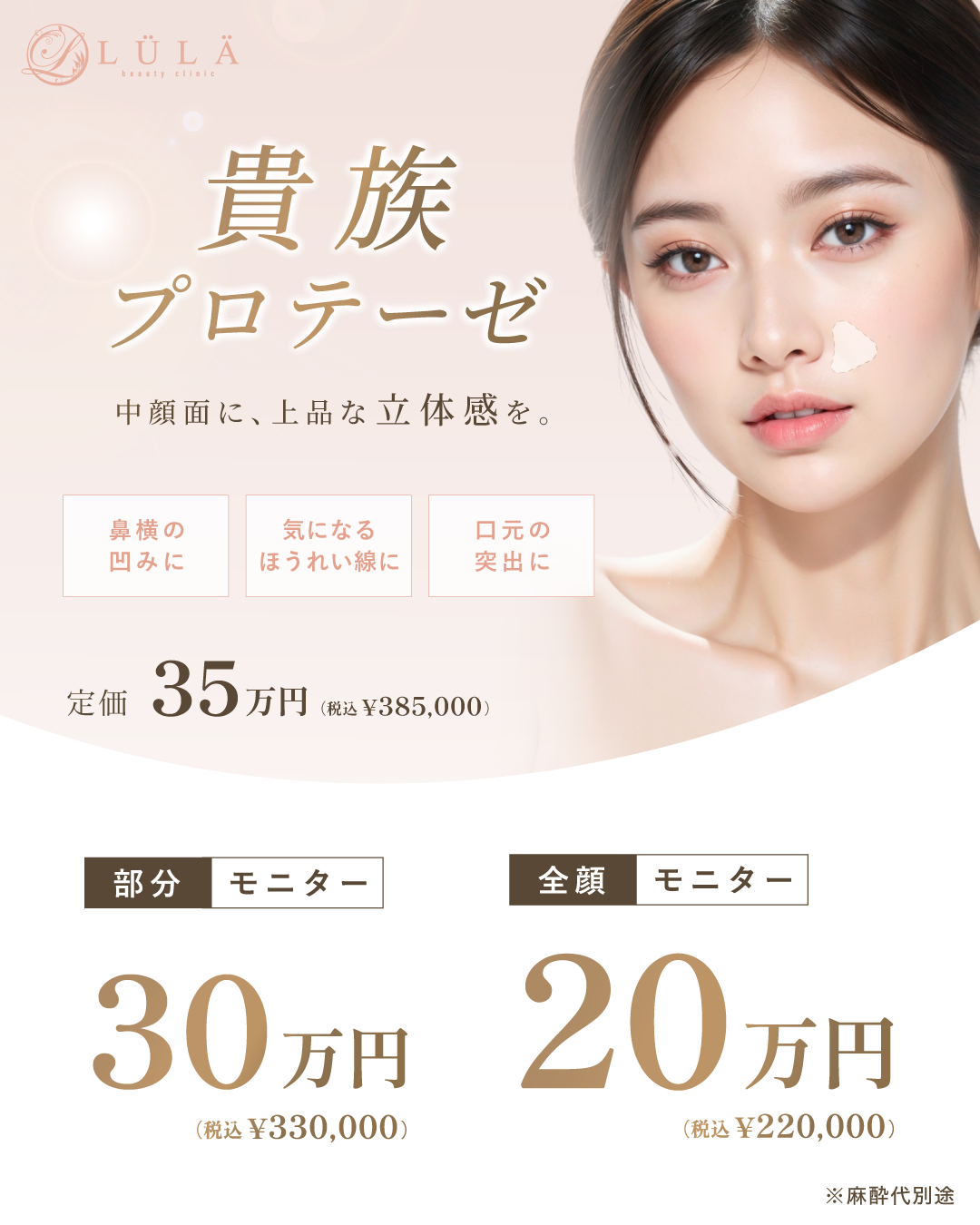 貴族手術(鼻翼基部プロテーゼ挿入術)